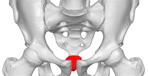 Coccydynia : causes , symptoms , diagnosis & treatment