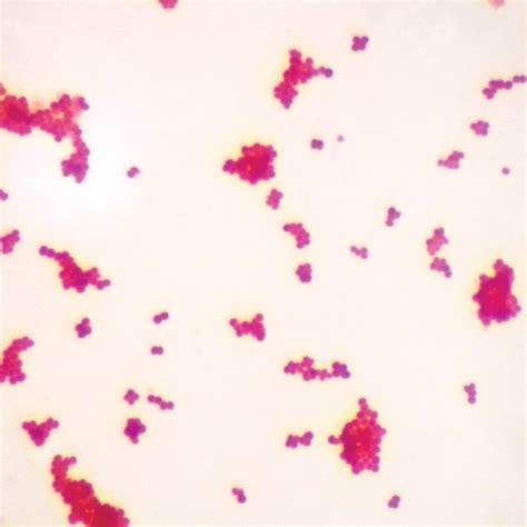 Gram-Negative Coccus, w.m. Gram Stain Microscope Slide | Carolina.com