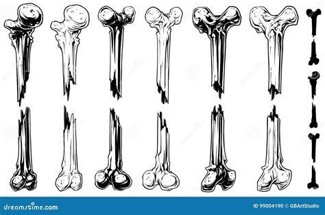 Graphic Black and White Broken Bones Vector Set Stock Vector ...