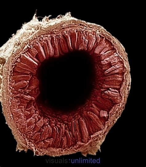 The small intestine seen here in cross section shows the numerous villi that greatly increase ...