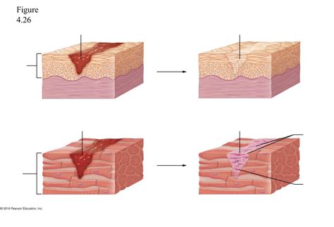 Tissue Repair By Regeneration or Fibrosis Diagram | Quizlet