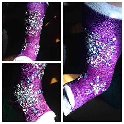 Decorated ankle cast with Bling..Snowflakes ️ Let it Go! | Cast decoration, Ankle cast, Arm cast