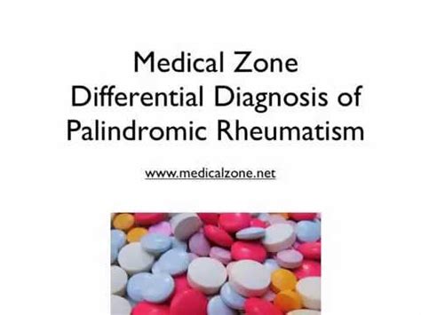 Medical Zone - Differential Diagnosis of Palindromic Rheumatism - YouTube