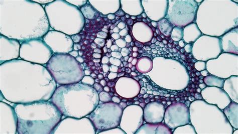 Monocot Stem: Vascular Bundle in Zea | cross section: Zea st… | Flickr