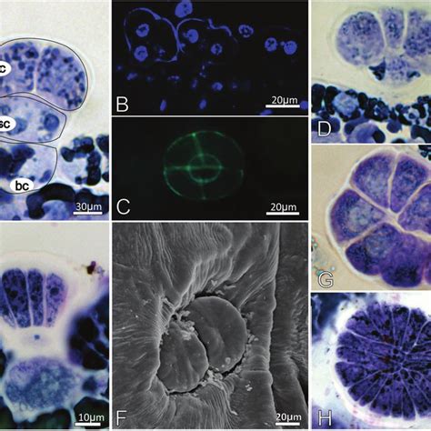 Leaf idioblasts of Myrsine coriacea (B, D, E) and Myrsine venosa (A, C,... | Download Scientific ...