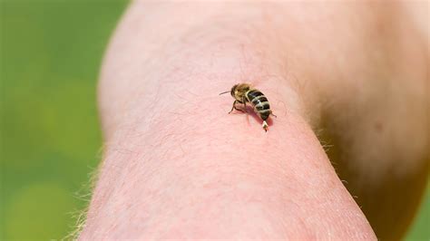 Treating a Bee Sting | Tips by Fantastic Pest Control Australia