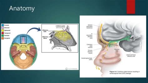 Csf Rhinorrhea - Overview