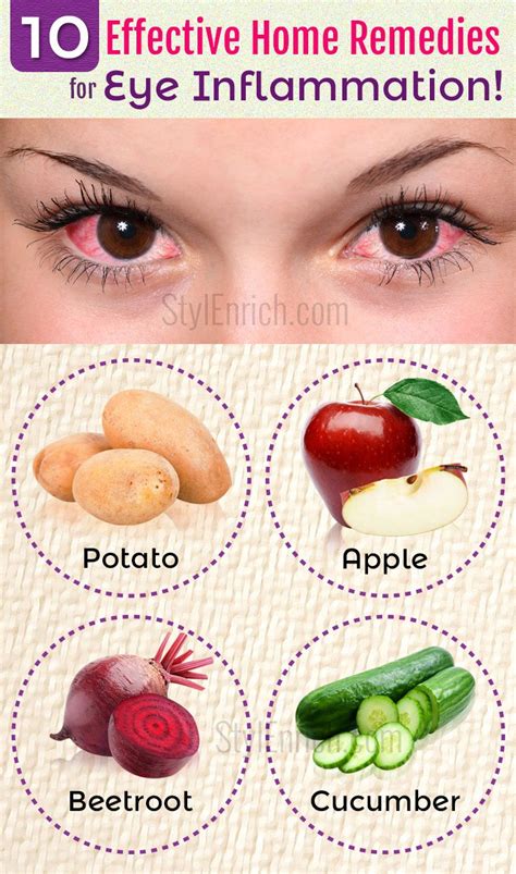 Home Remedies For Eye Inflammation - 10 Effective Ways