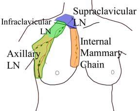 1-Schematic representation of the lymph nodes irradiated in radiation ...