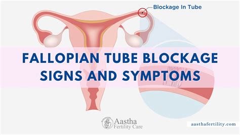 Fallopian Tube Blockage - Signs And Symptoms You Should Never Ignore