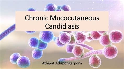 Chronic mucocutaneous candidiasis | PPT