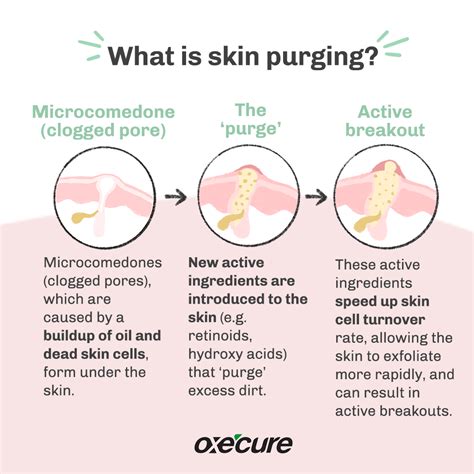 Oxecure PH - We know that “the purge” sounds scary, but...