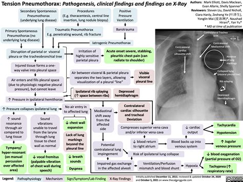 Pneumothorax Patofisiologi Diagnosis Penatalaksanaan Alomedika | The Best Porn Website