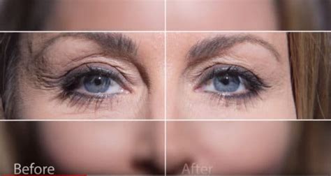 Instantly Ageless™ Before and After Photo Gallery, Jeunesse Global