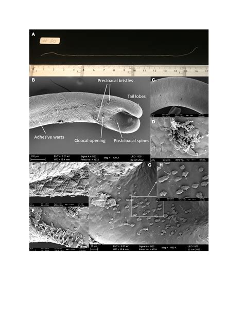 The genome sequence of the Montseny horsehair worm, Gordionus ...