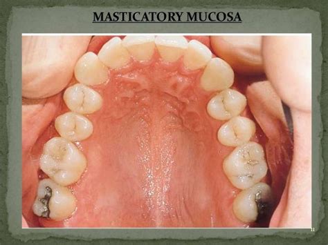 Oral mucous membrane