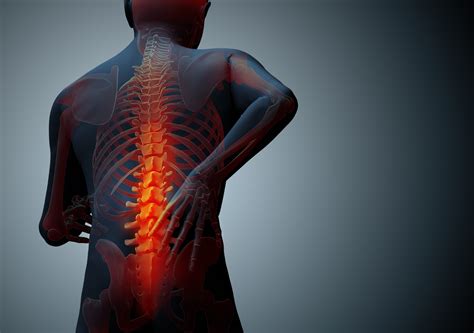 Vertebral Fracture Symptoms and Treatment ~ SGA Blogs | Guest Posting Service | A Platform to ...