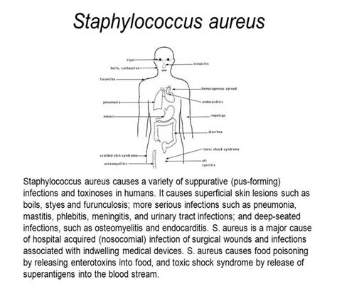 Staphylococcus Aureus Infection Symptoms