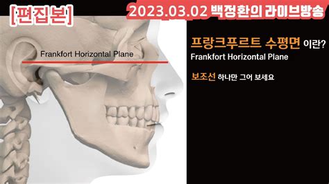 [백정환의 목요라방 편집본 #76] 프랑크푸르트 수평면(Frankfort horizontal plane) 이란? - YouTube