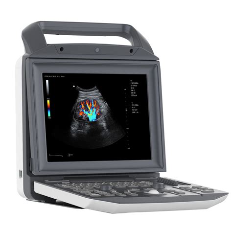 Ob/Gyn Color Doppler Portable Ultrasound Machine for Medical - China ...