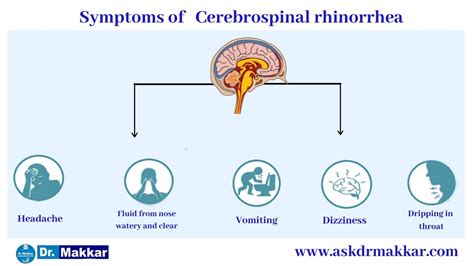 Cerebrospinal Rhinorrhea ||Nasal Fluid Brain || CSF Leakage || Causes ...