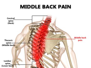 Mid Back Pain treatment in New York