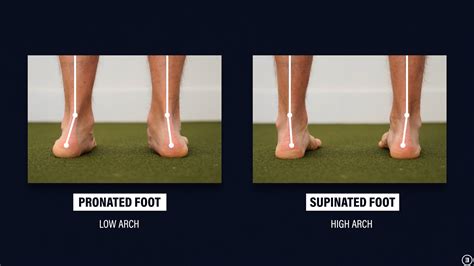 How to Correct Foot Posture: Tips and Exercises - FeetHealth