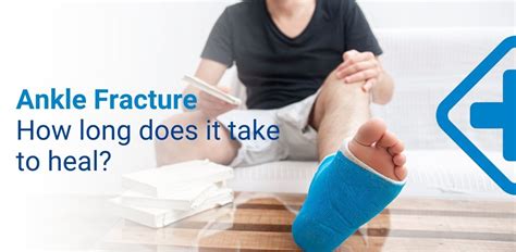 Ankle Fracture : How long does a fractured ankle take to heal?Symptoms & Treatment