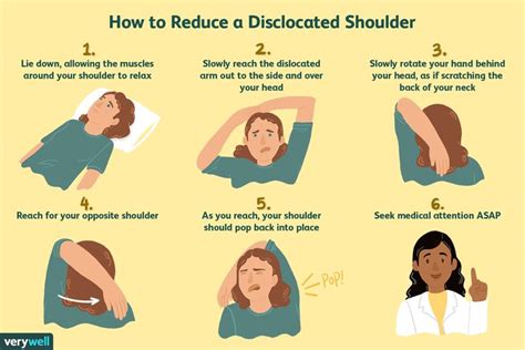 How to reduce a dislocated shoulder | Shoulder dislocation, Dislocated shoulder, Shoulder