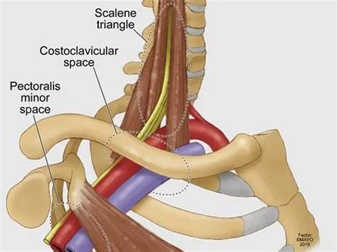 Aiello Family Chiropractic | Scalene Syndrome