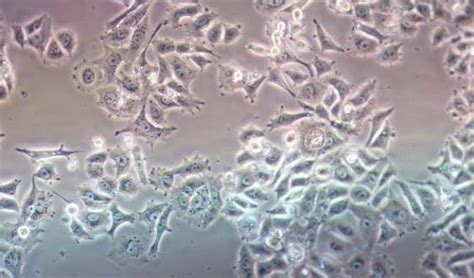 Mycoplasma Contamination In Cell Culture