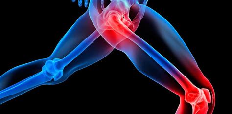 What Is the Cause of Your Knee Pain? — Ortho San Antonio