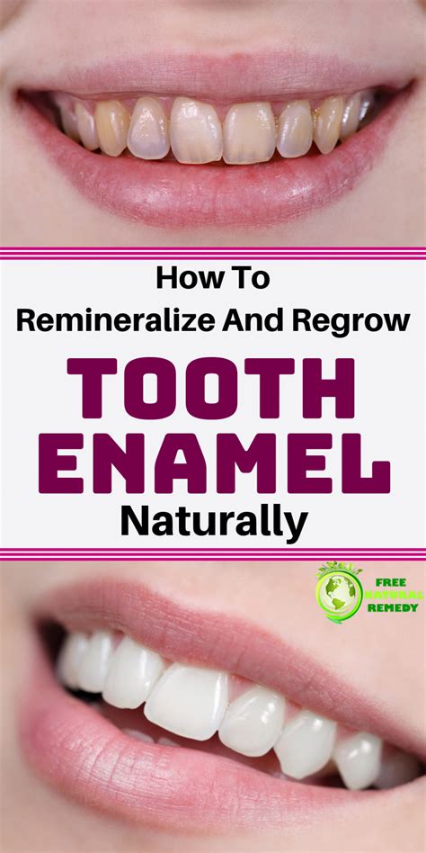 How To Naturally Remineralize And Regrow Tooth Enamel! | Tooth enamel ...