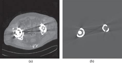 A new approach for reducing beam hardening artifacts in polychromatic X-ray computed tomography ...