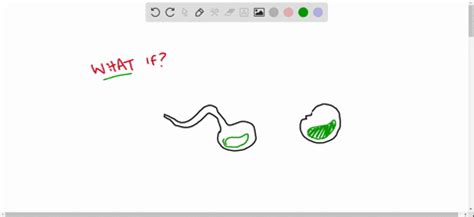 ⏩SOLVED:What would the results of Pasteur's swan-neck flask… | Numerade