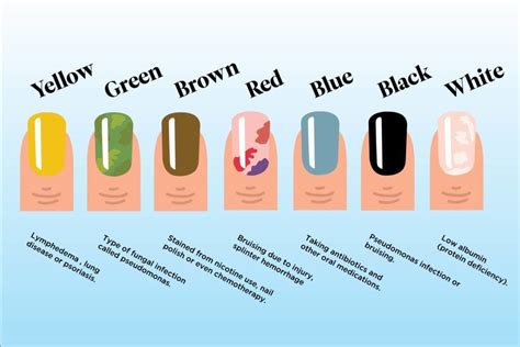 What Your Nail Color Says About Your Health | Reader's Digest