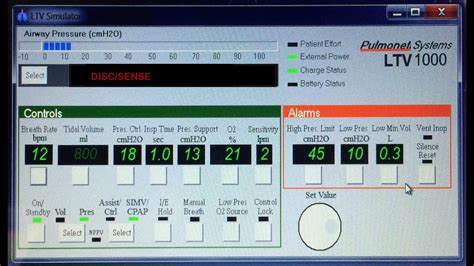 VTE, VE, I/E RATIO, MAP, PEEP, PIP, f. LTV VENTILATOR EXPLAINED - YouTube