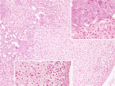 Epitelial: glándula suprarrenal. Atlas de Histología Vegetal y Animal ...