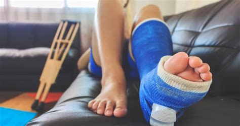 Broken Leg Injuries - The Eichholz Law Firm