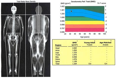 My DEXA Scan for Body Composition - BJJ Caveman