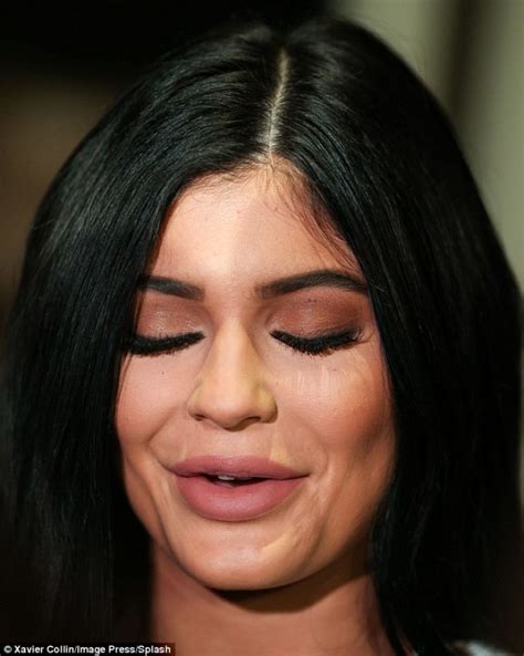 Kylie Jenner déformée par la chirurgie, la photo choc !! est l’exemple ...