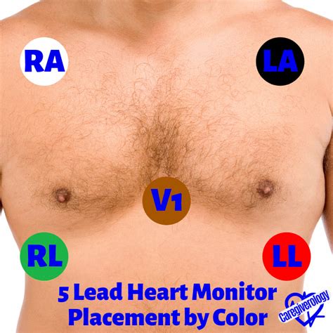 Heart Monitor Basics and Troubleshooting - Caregiverology | Heart ...