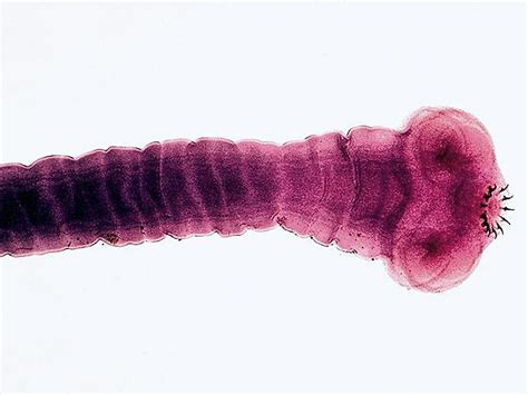 Parasite Worms In Humans