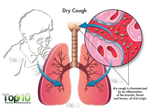 Home Remedies For Cough | Top 10 Home Remedies