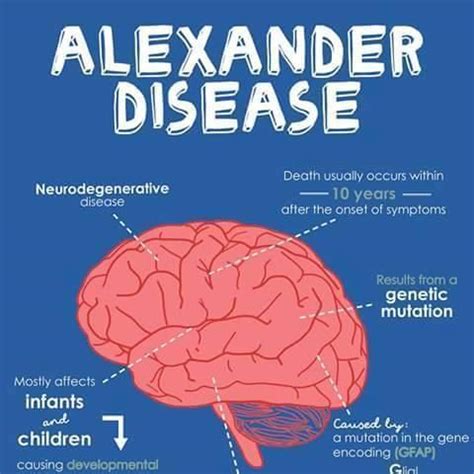 Alexander Disease - Home