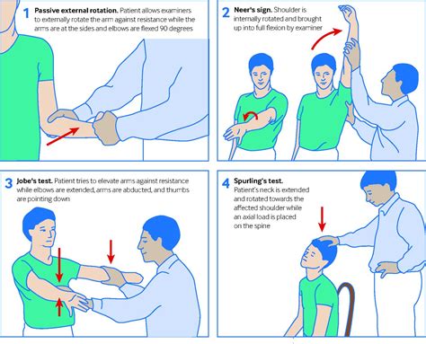 Assessment of shoulder pain for non-specialists | The BMJ