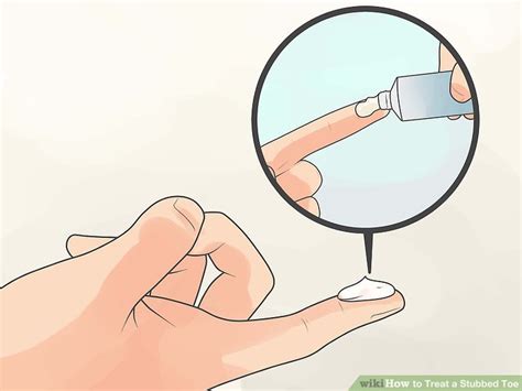 How to Treat a Stubbed Toe: 14 Steps (with Pictures) - wikiHow