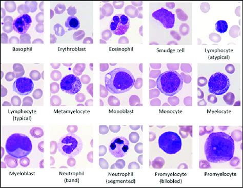 Samples of the fifteen different types of WBC presented in the primary... | Download Scientific ...