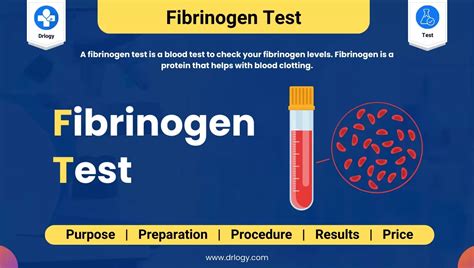 Is Fibrinogen present in urine?