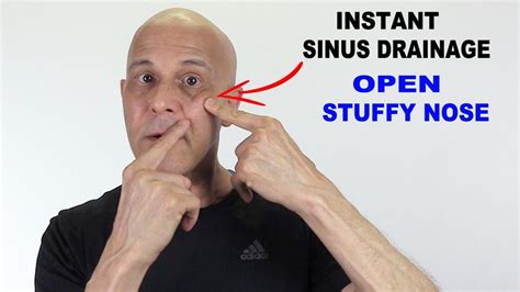 INSTANT SINUS DRAINAGE | OPEN STUFFY NOSE - Dr Alan Mandell, DC ...